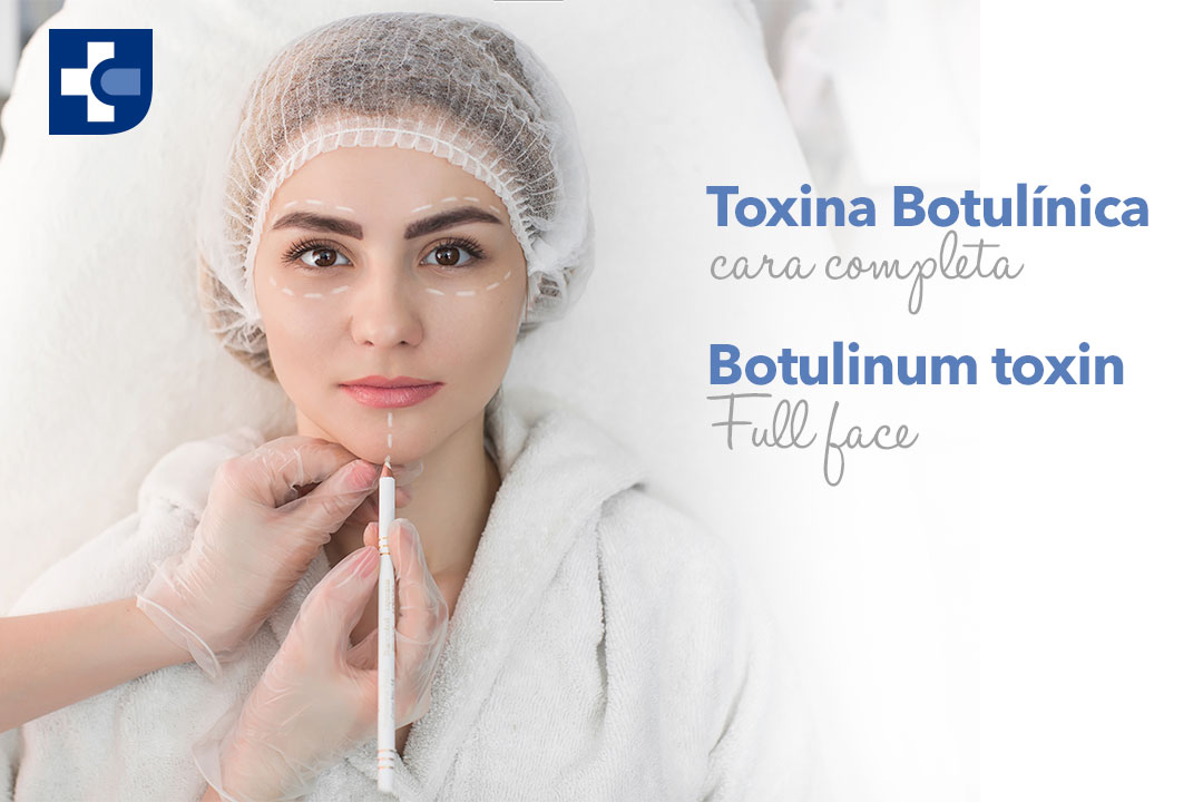 Botox-Cara-completa.jpg