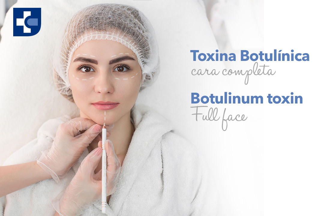 Botox-Cara-completa.jpg