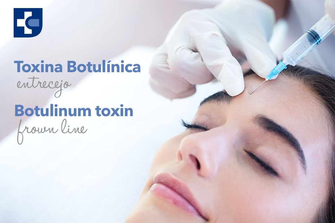 Botox-Entrecejo.jpg