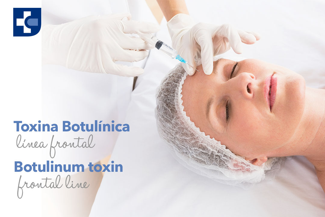 Botox-Linea-frontal.jpg