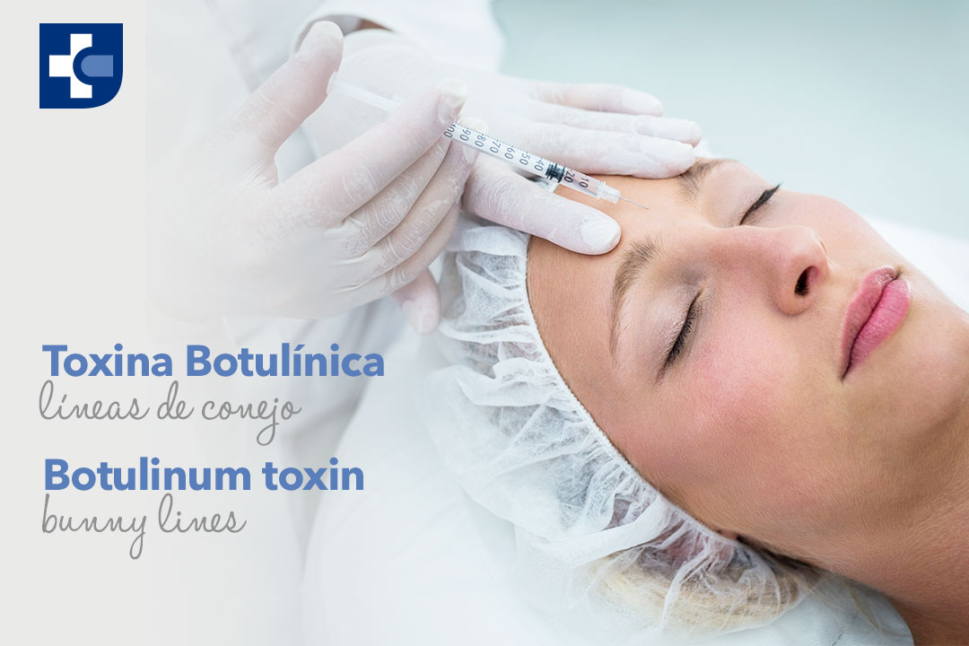 Botox-Lineas-de-conejo.jpg